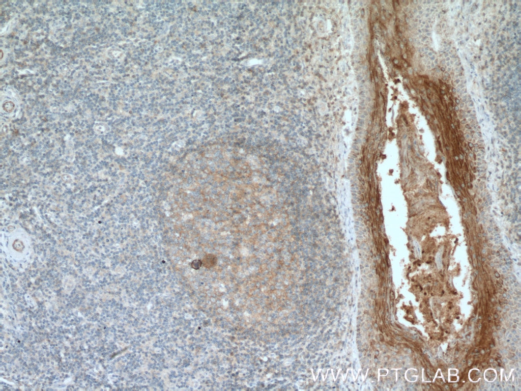 Immunohistochemistry (IHC) staining of human tonsillitis tissue using FCHO1 Polyclonal antibody (26767-1-AP)