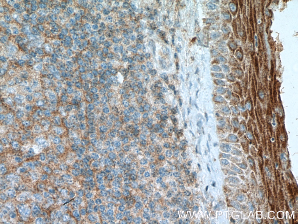 Immunohistochemistry (IHC) staining of human tonsillitis tissue using FCHO1 Polyclonal antibody (26767-1-AP)