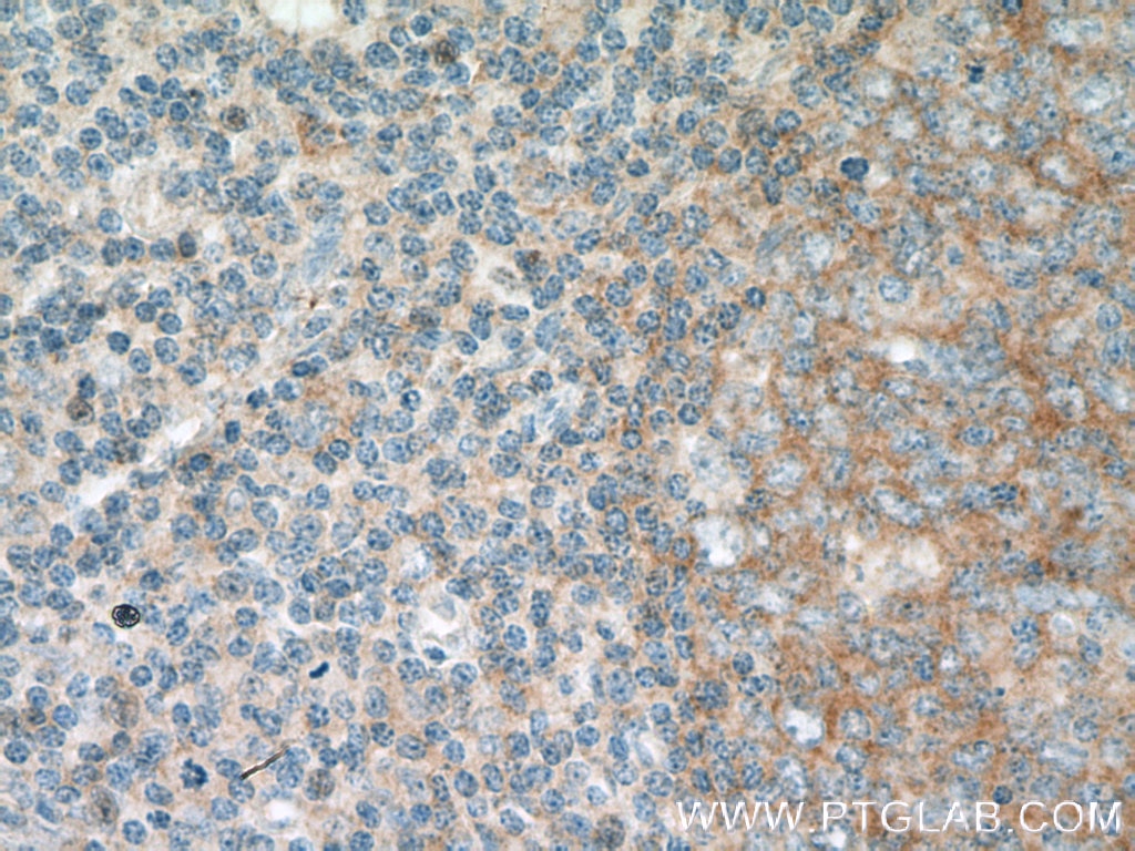 Immunohistochemistry (IHC) staining of human tonsillitis tissue using FCHO1 Polyclonal antibody (26767-1-AP)