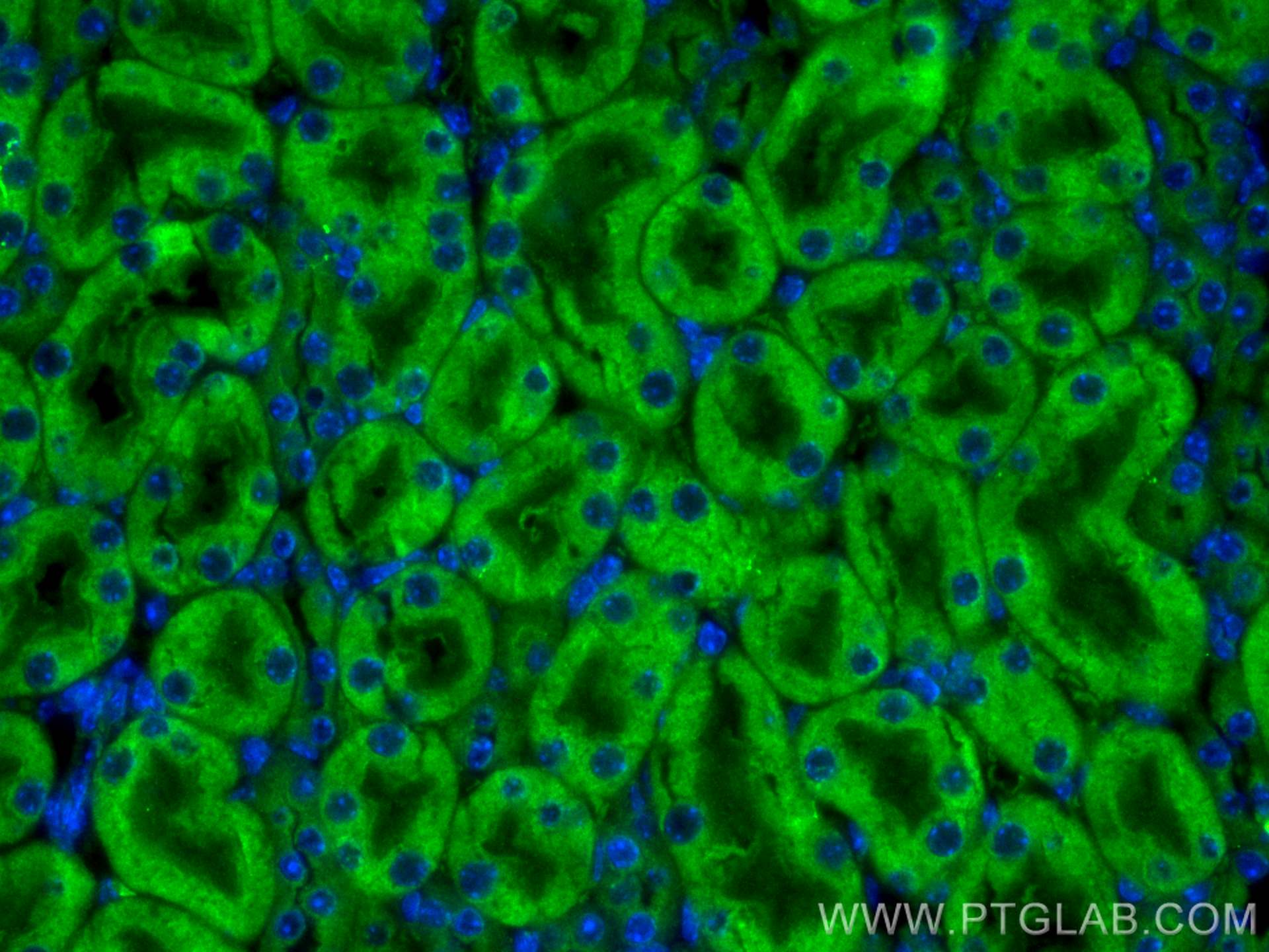 Immunofluorescence (IF) / fluorescent staining of mouse kidney tissue using FCHSD1 Polyclonal antibody (23362-1-AP)