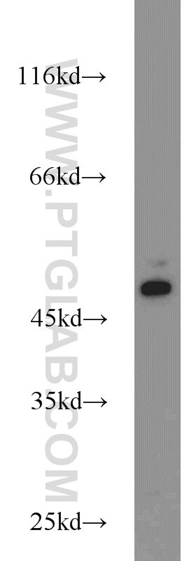 Western Blot (WB) analysis of K-562 cells using FCHSD1 Polyclonal antibody (23362-1-AP)