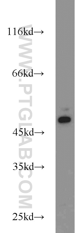 WB analysis of K-562 using 23362-1-AP