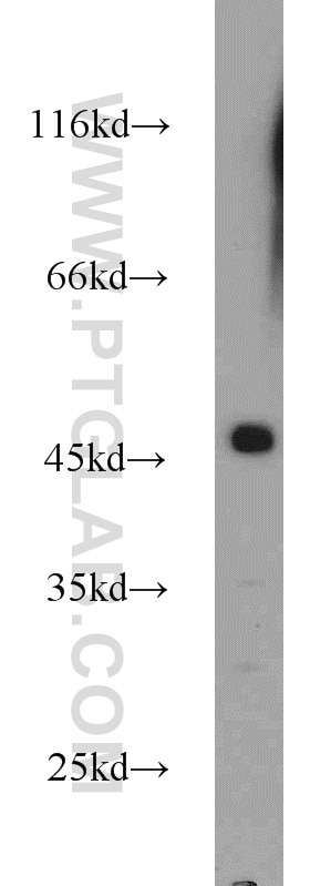 Western Blot (WB) analysis of HeLa cells using FCHSD1 Polyclonal antibody (23362-1-AP)