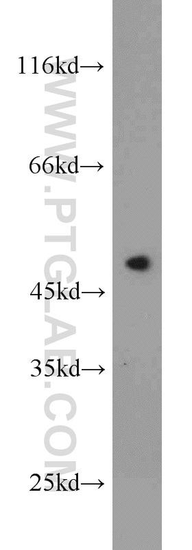 Western Blot (WB) analysis of Jurkat cells using FCHSD1 Polyclonal antibody (23362-1-AP)
