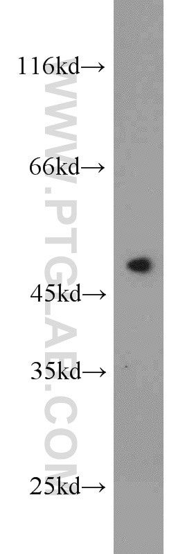 WB analysis of Jurkat using 23362-1-AP