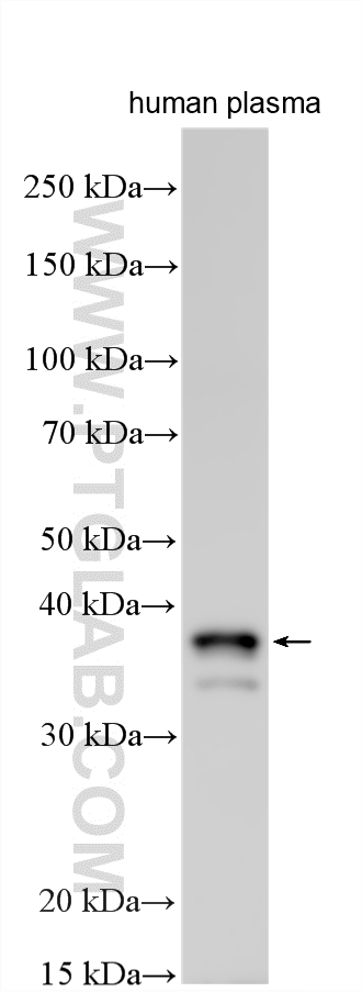 WB analysis using 11775-1-AP Western Blot (WB) analysis of various lysates using Ficolin 1 Polyclonal antibody (11775-1-AP)