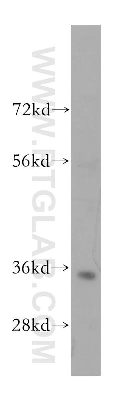 Western Blot (WB) analysis of K-562 cells using FCN1 Polyclonal antibody (11775-1-AP)