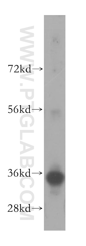 Western Blot (WB) analysis of human liver tissue using FCN1 Polyclonal antibody (11775-1-AP)