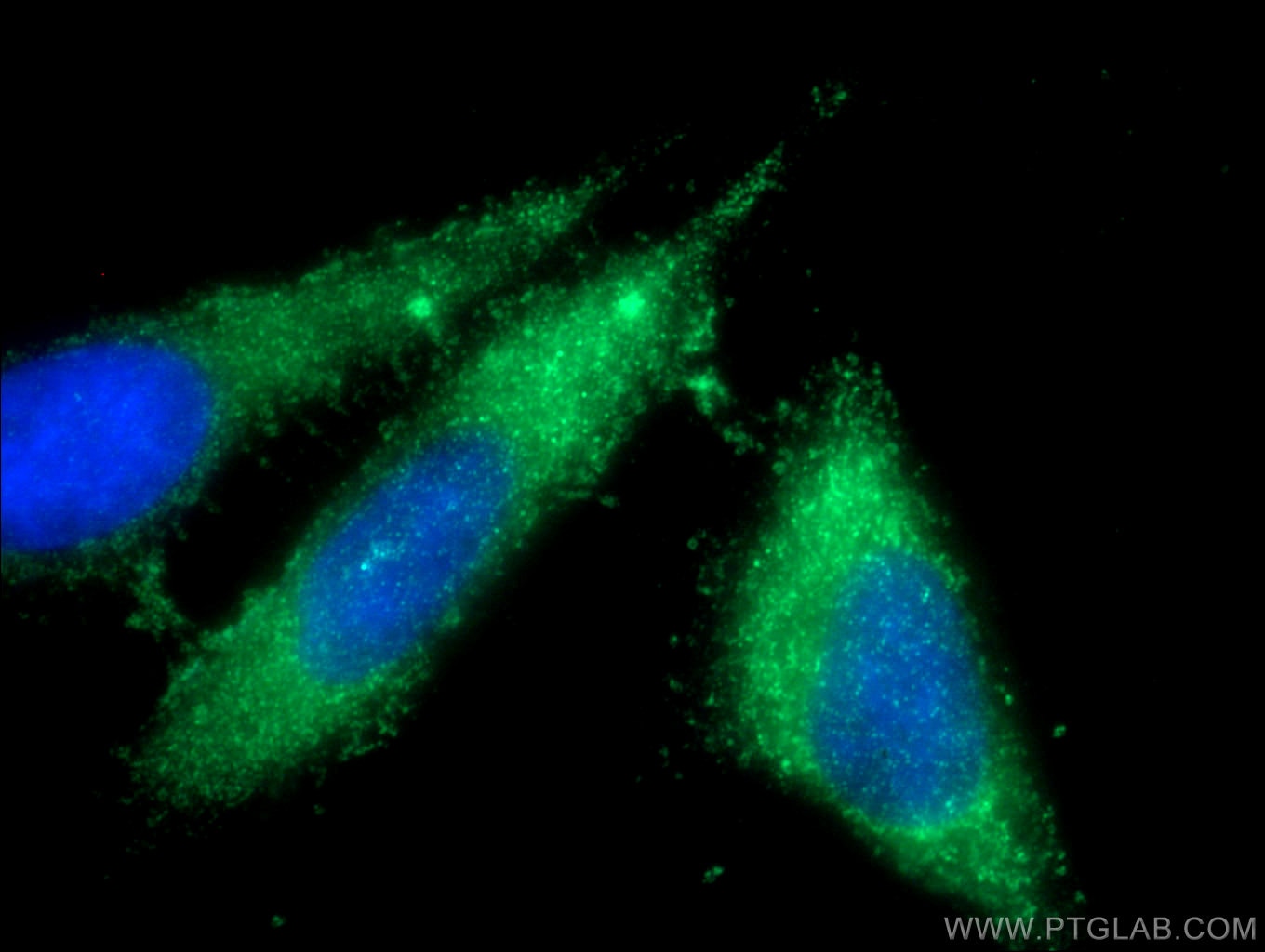 Immunofluorescence (IF) / fluorescent staining of HepG2 cells using Ficolin-3 Polyclonal antibody (11867-1-AP)