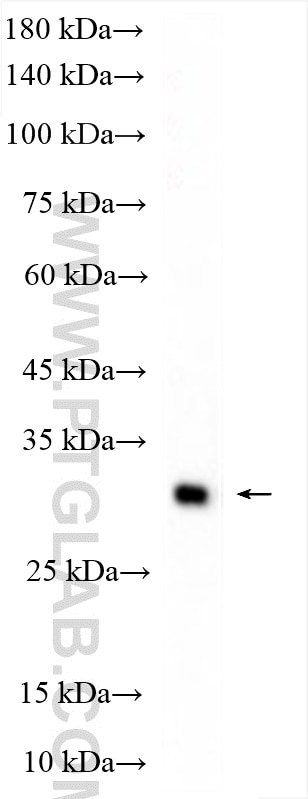 Western Blot (WB) analysis of human plasma using Ficolin-3 Polyclonal antibody (11867-1-AP)