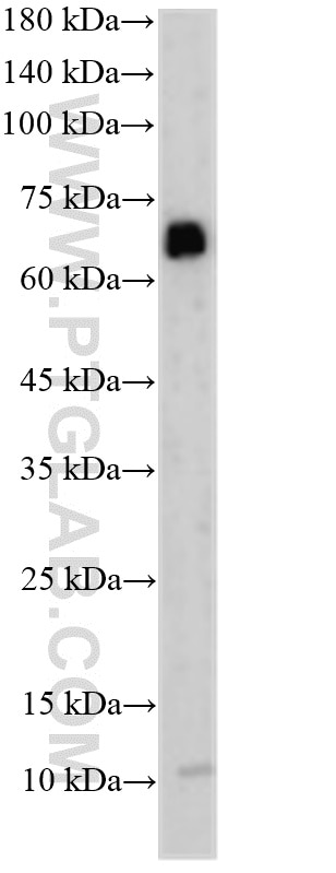 WB analysis of HeLa using 33416-1-AP Western Blot (WB) analysis of HeLa cells using FCRL2 Polyclonal antibody (33416-1-AP)