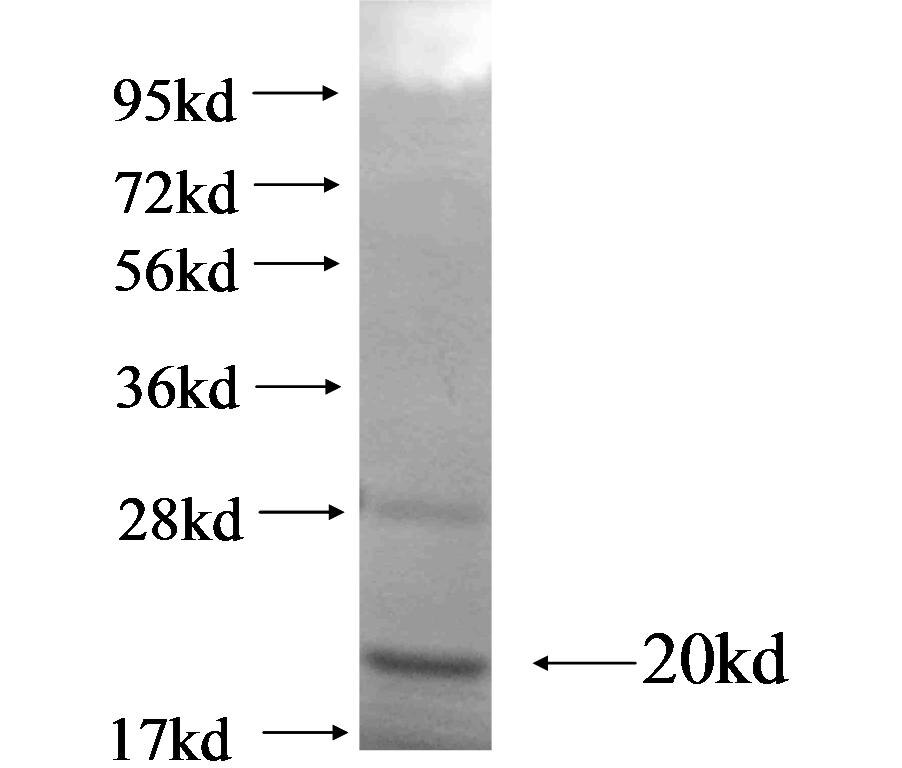 FCRL2 fusion protein Ag19135 SDS-PAGE