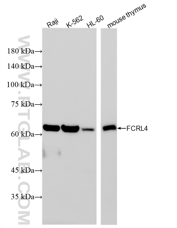 Western Blot (WB) analysis of various lysates using FCRL4 Recombinant monoclonal antibody (86941-1-RR)