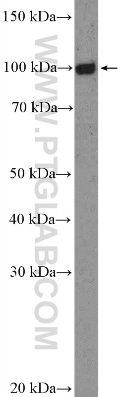 Western Blot (WB) analysis of Daudi  cells using FCRL5 Polyclonal antibody (26503-1-AP)