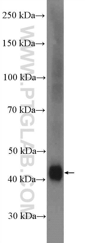 Western Blot (WB) analysis of Daudi  cells using FCRLA Polyclonal antibody (26949-1-AP)