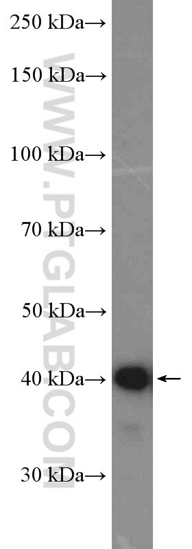 Western Blot (WB) analysis of Raji cells using FCRLA Polyclonal antibody (26949-1-AP)