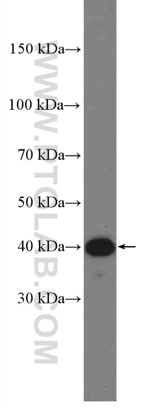 Western Blot (WB) analysis of Raji cells using FCRLA Polyclonal antibody (26949-1-AP)