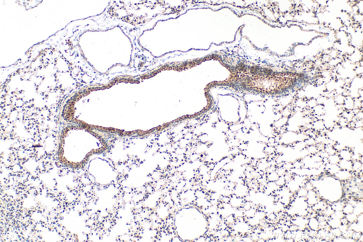 Immunohistochemistry (IHC) staining of mouse lung tissue using FCRLB Polyclonal antibody (17157-1-AP)