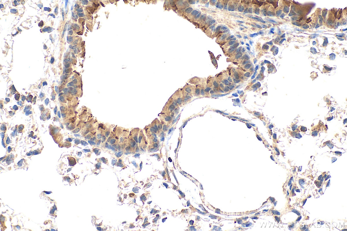 Immunohistochemistry (IHC) staining of mouse lung tissue using FCRLB Polyclonal antibody (17157-1-AP)