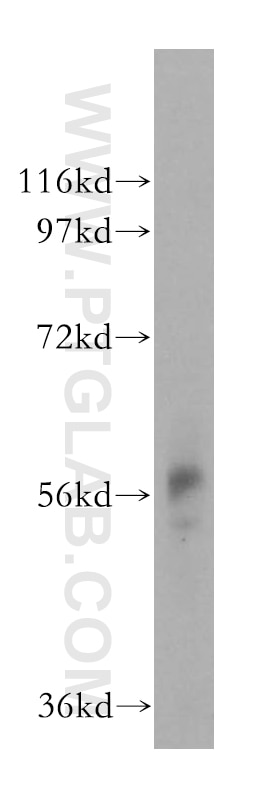 Western Blot (WB) analysis of mouse lung tissue using FCRLB Polyclonal antibody (17157-1-AP)