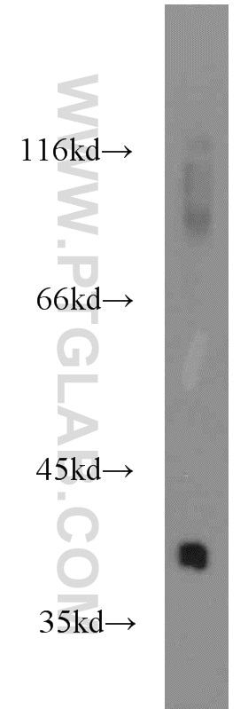 WB analysis of rat liver using 16129-1-AP