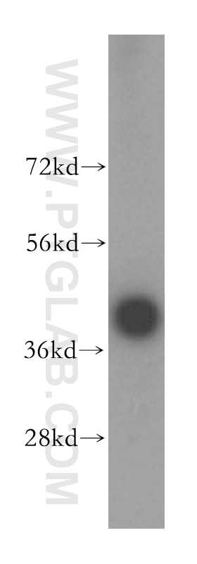 Western Blot (WB) analysis of human cerebellum tissue using FDPS Polyclonal antibody (16129-1-AP)