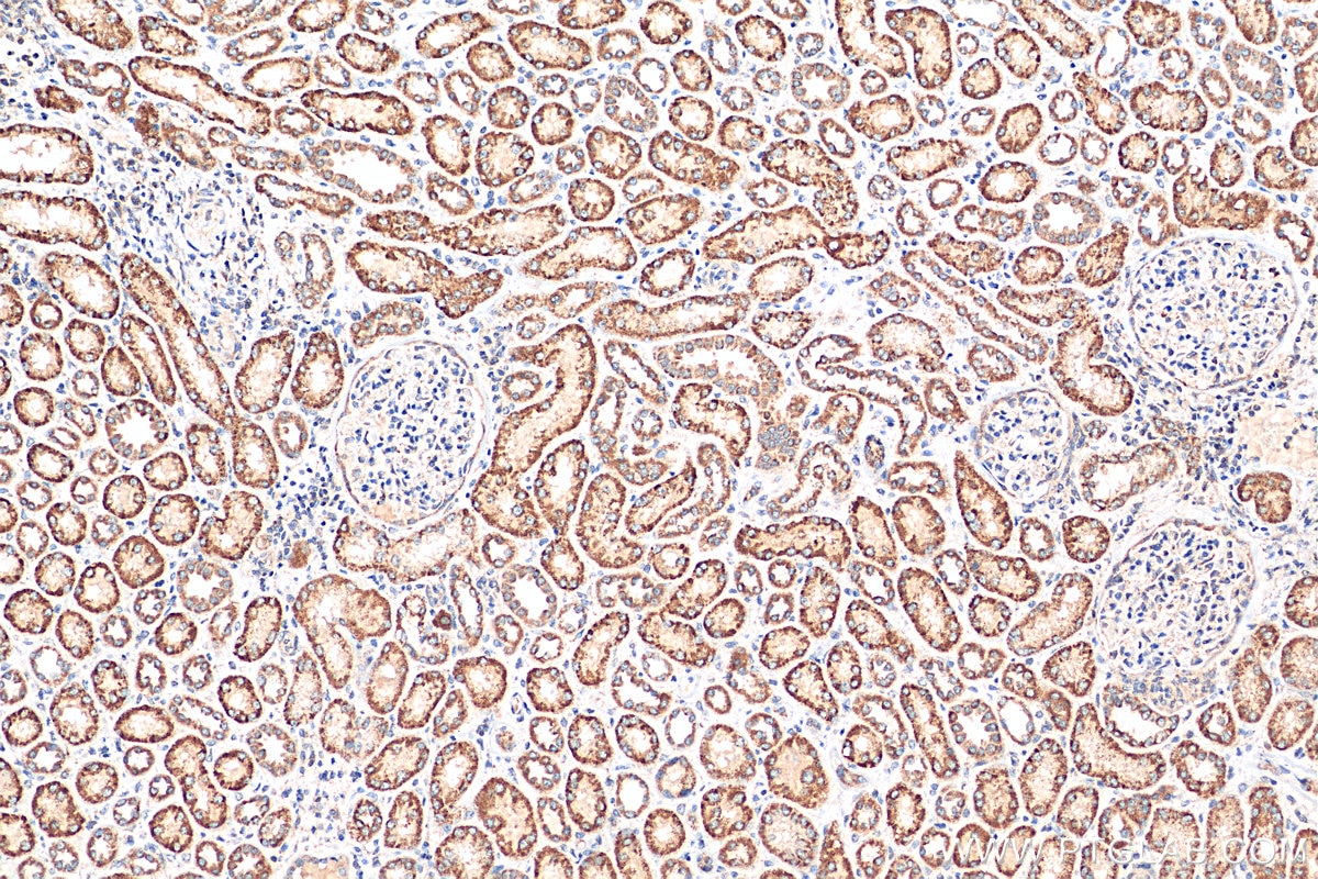 Immunohistochemistry (IHC) staining of human kidney tissue using FDX1 Polyclonal antibody (12592-1-AP)