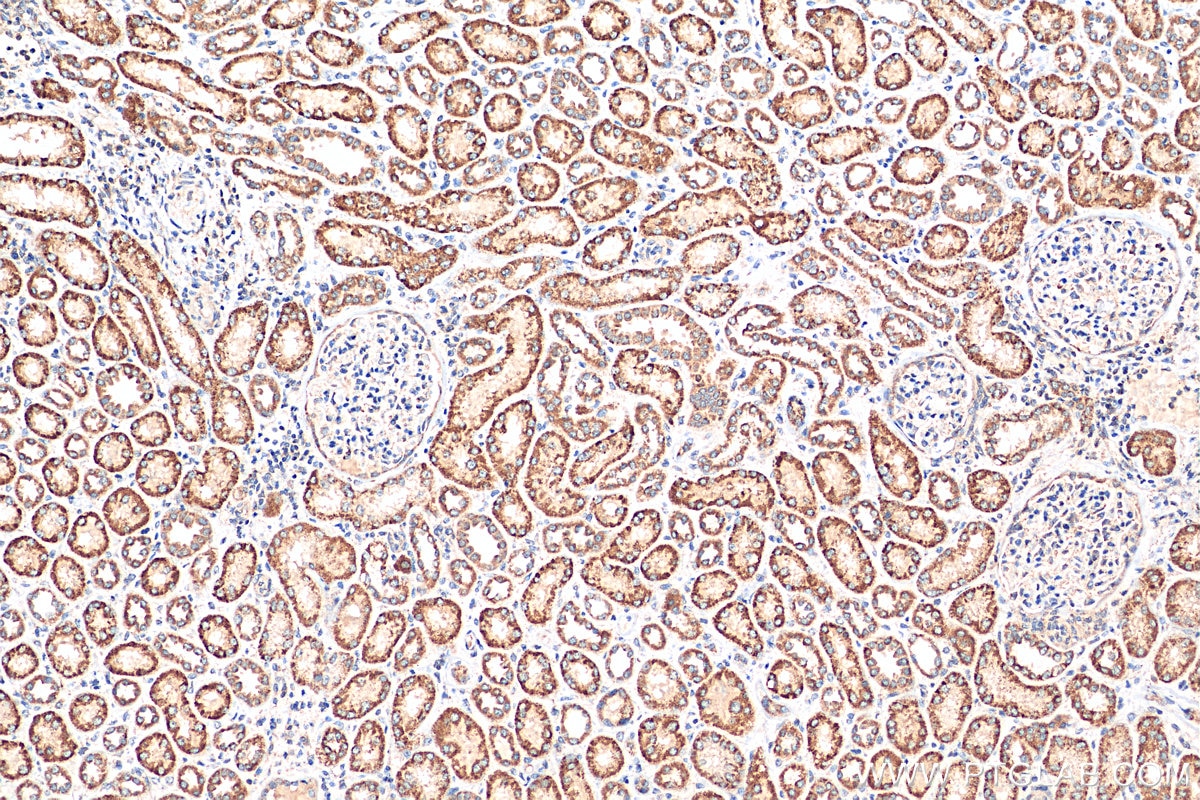 IHC staining of human kidney using 12592-1-AP