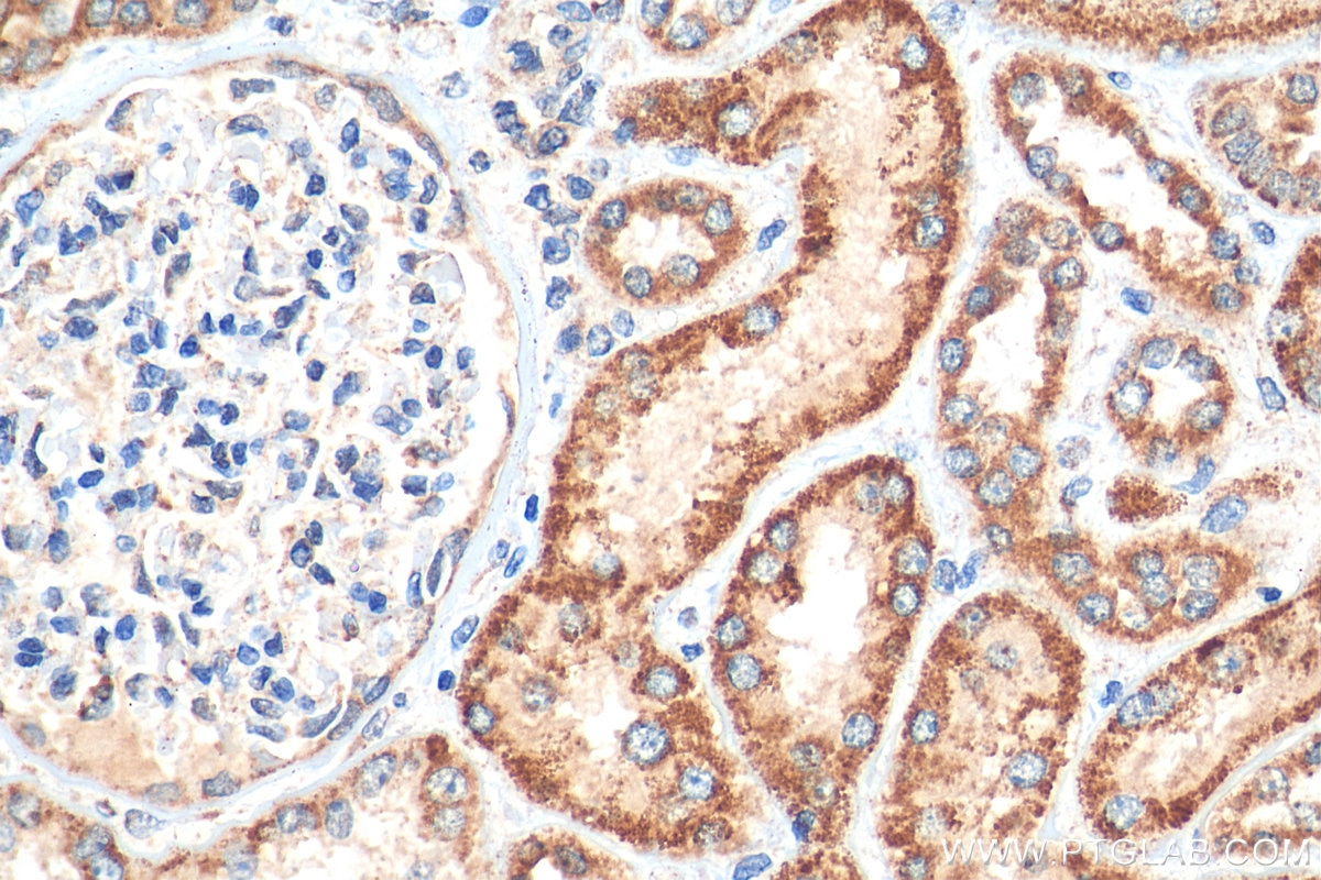 Immunohistochemistry (IHC) staining of human kidney tissue using FDX1 Polyclonal antibody (12592-1-AP)