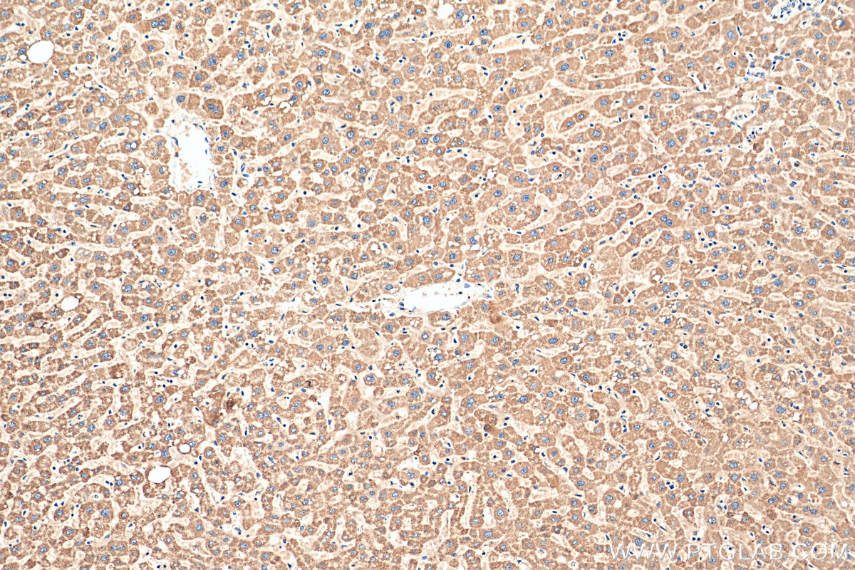 IHC staining of human liver using 12592-1-AP