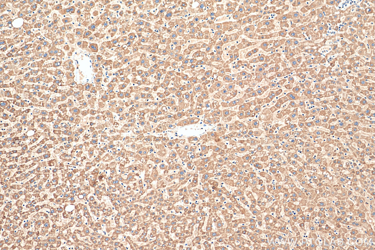 Immunohistochemistry (IHC) staining of human liver tissue using FDX1 Polyclonal antibody (12592-1-AP)