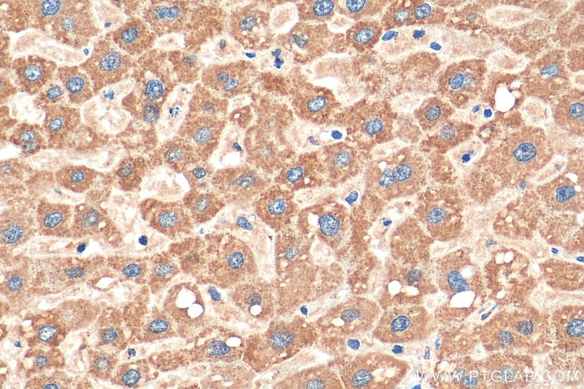 Immunohistochemistry (IHC) staining of human liver tissue using FDX1 Polyclonal antibody (12592-1-AP)