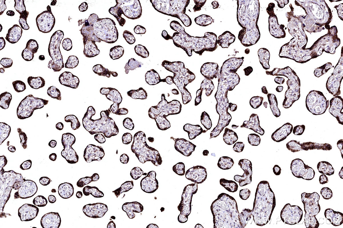 IHC staining of human placenta using 12592-1-AP Immunohistochemistry (IHC) staining of human placenta tissue using FDX1 Polyclonal antibody (12592-1-AP)