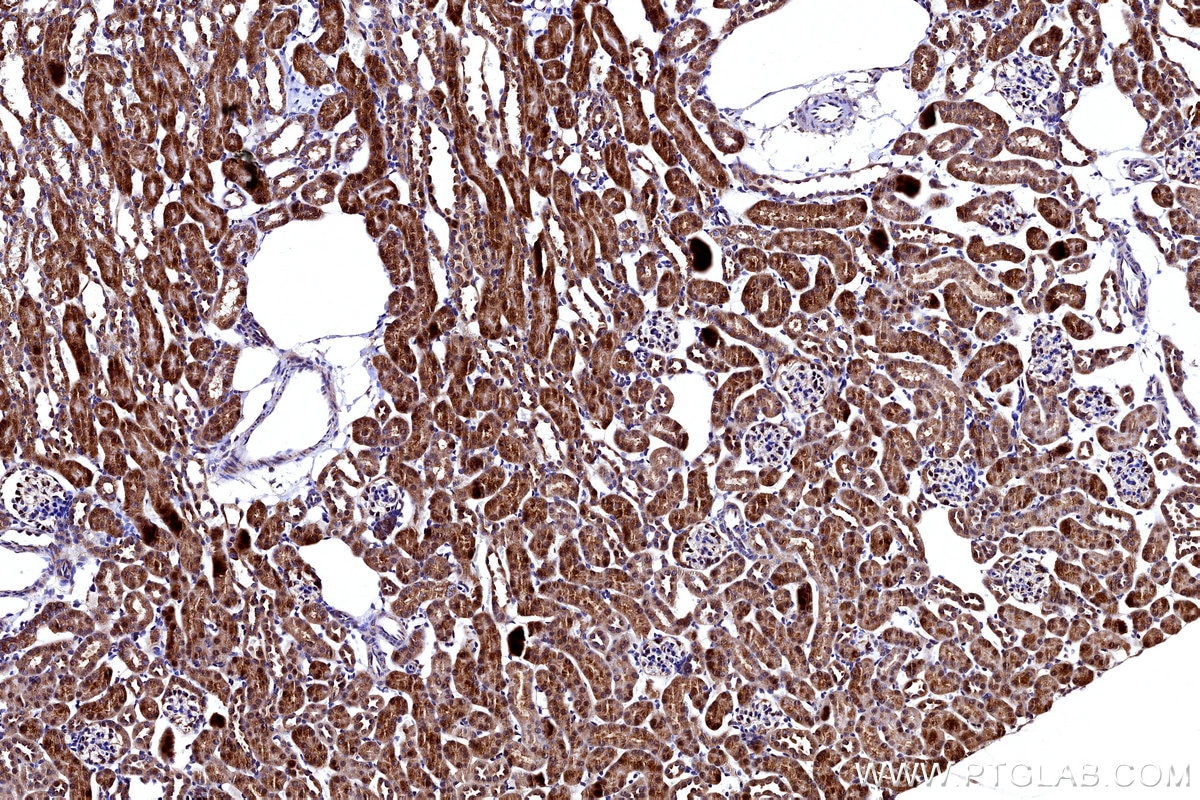 IHC staining of mouse kidney using 12592-1-AP Immunohistochemistry (IHC) staining of mouse kidney tissue using FDX1 Polyclonal antibody (12592-1-AP)