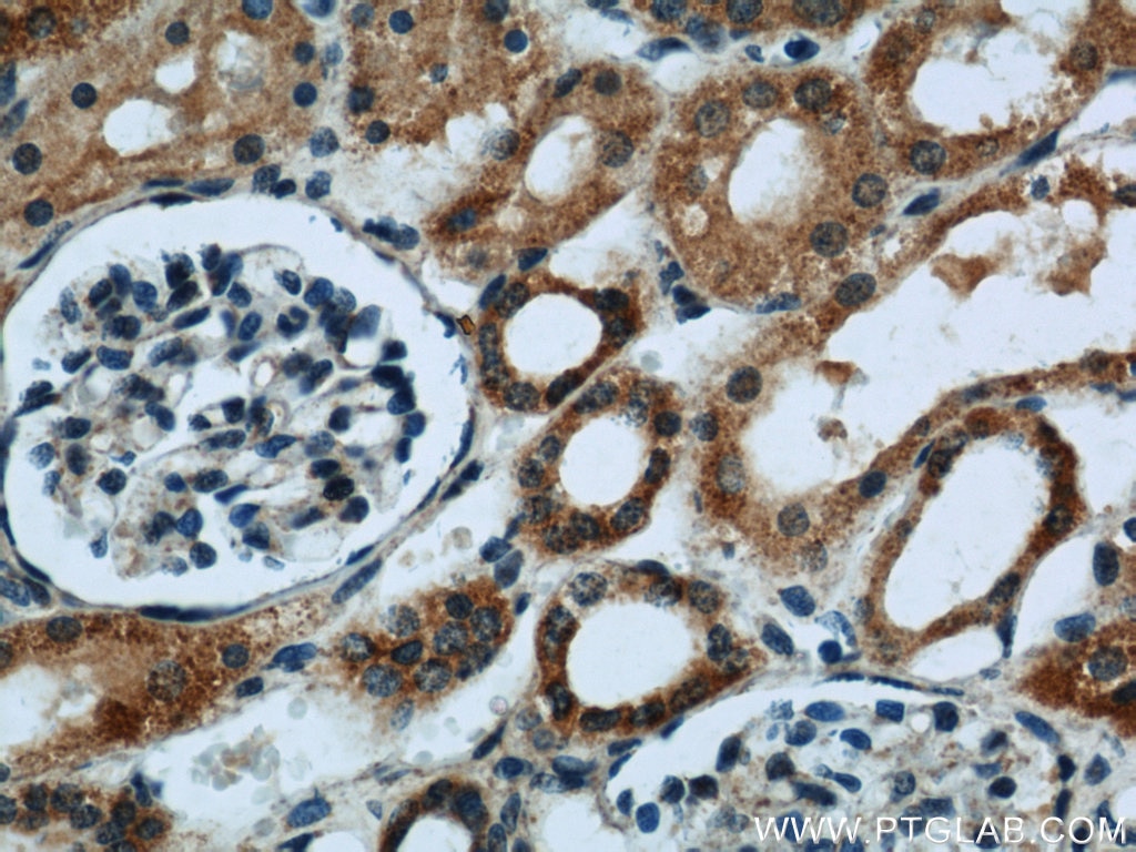 FDX1 Polyclonal antibody