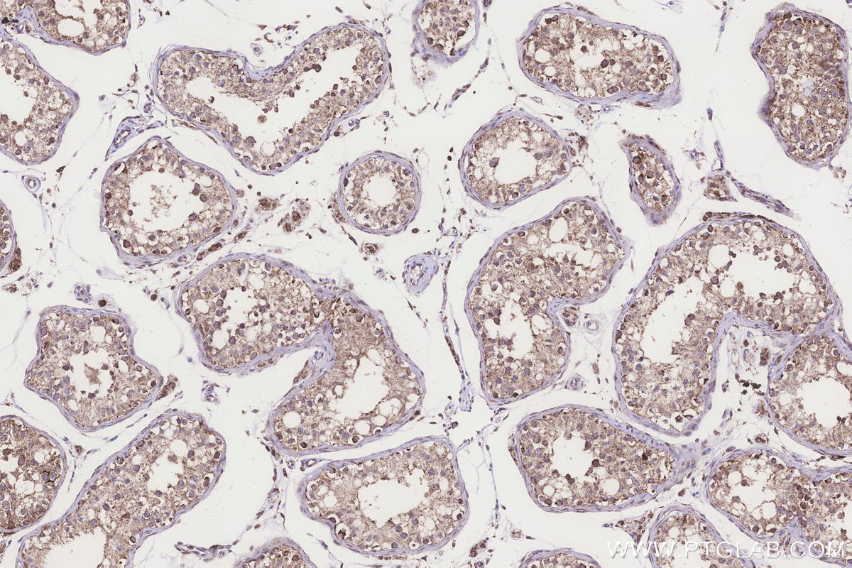 IHC staining of human testis using 32790-1-AP Immunohistochemistry (IHC) staining of human testis tissue using FDX1L Polyclonal antibody (32790-1-AP)
