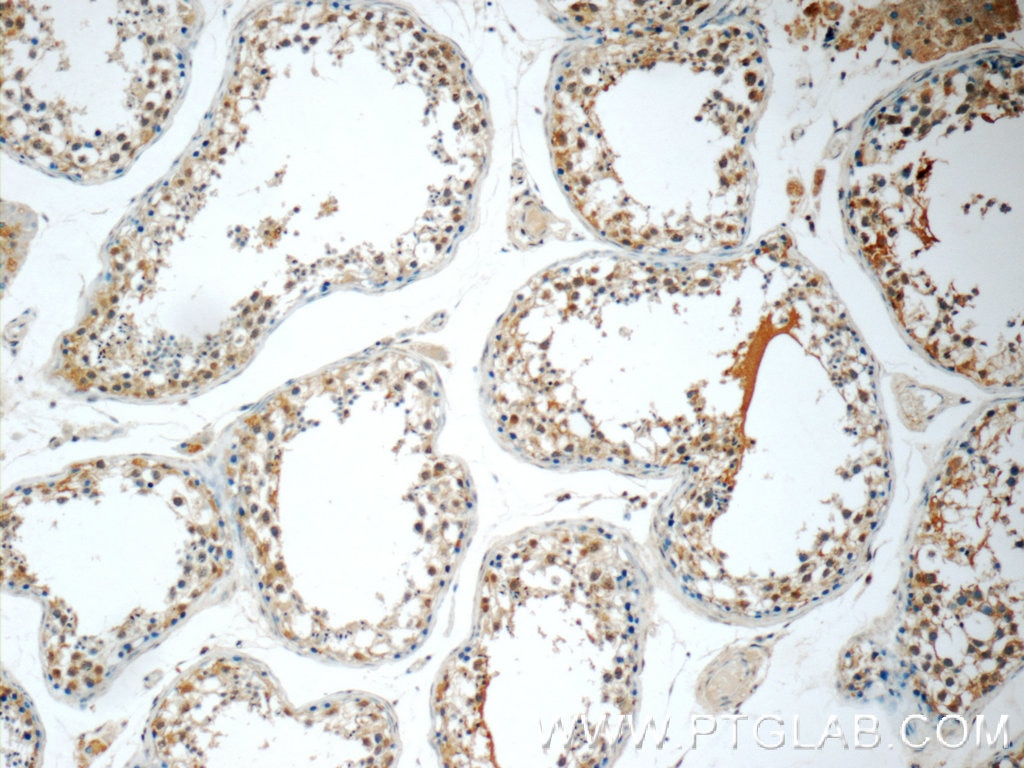 Immunohistochemistry (IHC) staining of human testis tissue using FDXACB1 Polyclonal antibody (24981-1-AP)