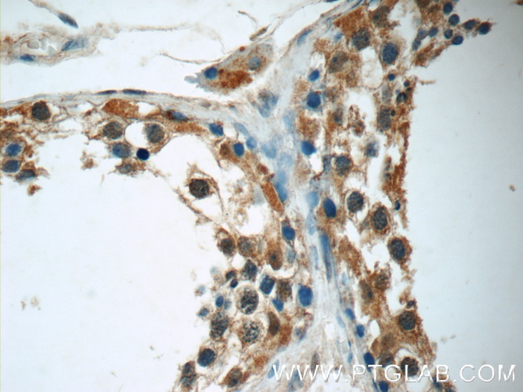 Immunohistochemistry (IHC) staining of human testis tissue using FDXACB1 Polyclonal antibody (24981-1-AP)