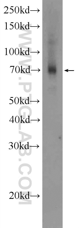 Western Blot (WB) analysis of human placenta tissue using FDXACB1 Polyclonal antibody (24981-1-AP)