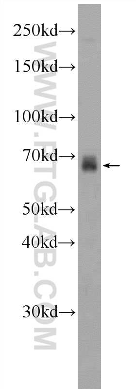 Western Blot (WB) analysis of PC-3 cells using FDXACB1 Polyclonal antibody (24981-1-AP)
