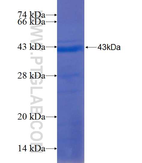 FDXACB1 fusion protein Ag21785 SDS-PAGE