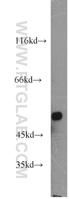 Western Blot (WB) analysis of human adrenal gland tissue using FDXR Polyclonal antibody (15584-1-AP)