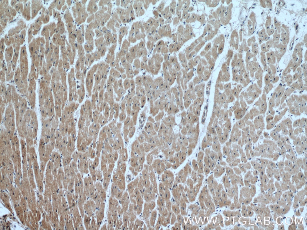 Immunohistochemistry (IHC) staining of human heart tissue using FECH Polyclonal antibody (14466-1-AP)