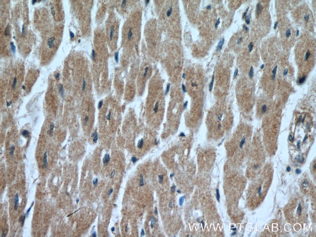 Immunohistochemistry (IHC) staining of human heart tissue using FECH Polyclonal antibody (14466-1-AP)