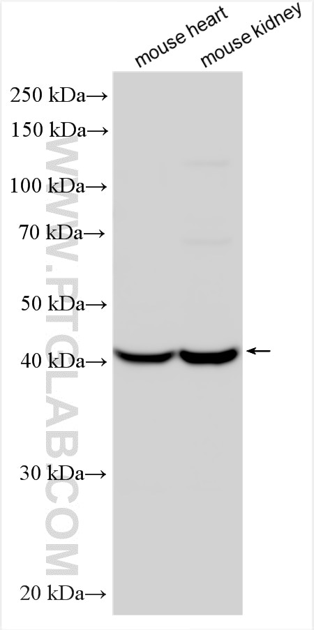 Western Blot (WB) analysis of various lysates using FECH Polyclonal antibody (14466-1-AP)