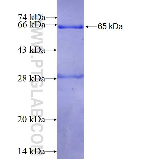 FECH fusion protein Ag5814 SDS-PAGE