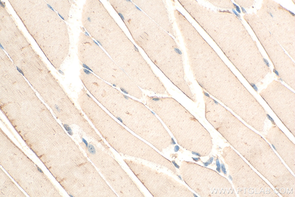 Immunohistochemistry (IHC) staining of mouse skeletal muscle tissue using FEM1A Polyclonal antibody (15169-1-AP)