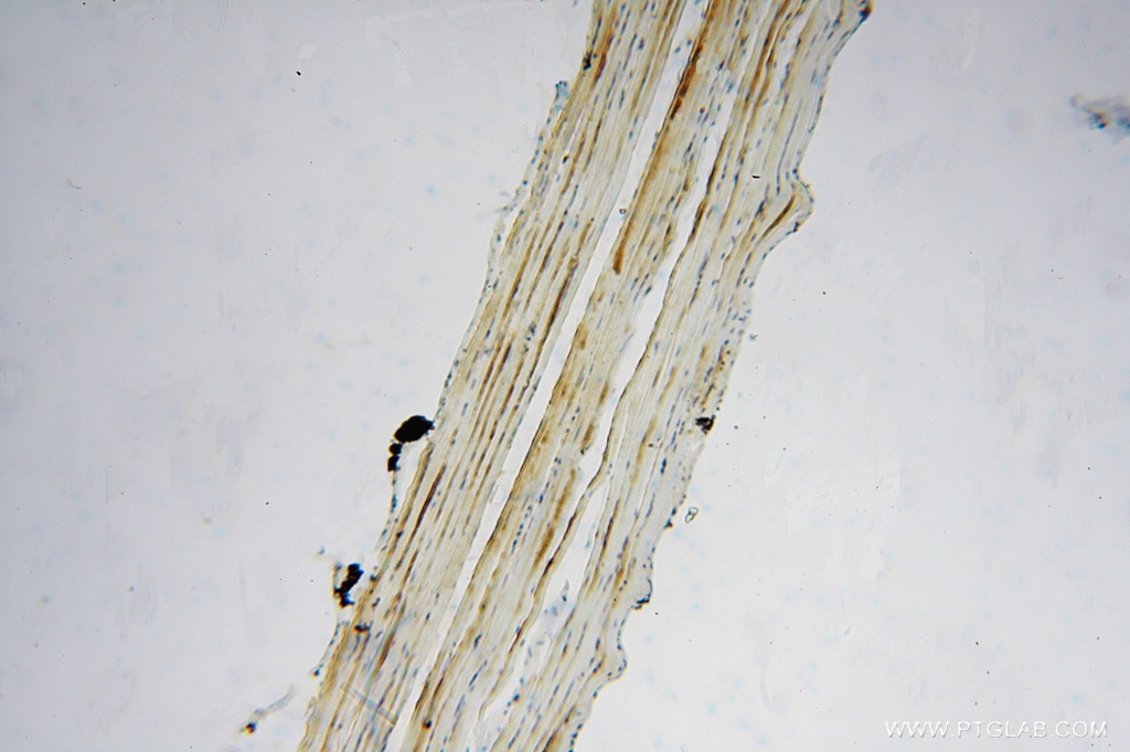IHC staining of human skeletal muscle using 15169-1-AP