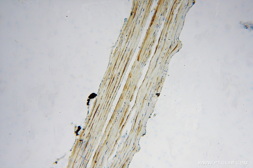 Immunohistochemistry (IHC) staining of human skeletal muscle tissue using FEM1A Polyclonal antibody (15169-1-AP)