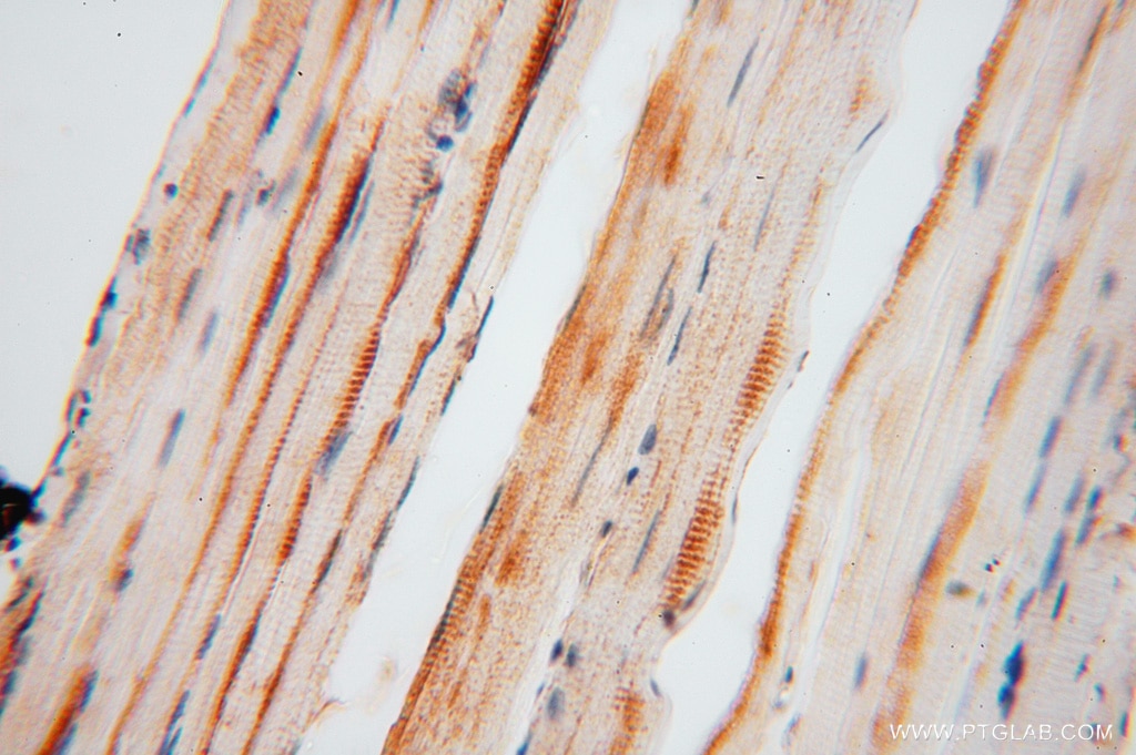 Immunohistochemistry (IHC) staining of human skeletal muscle tissue using FEM1A Polyclonal antibody (15169-1-AP)